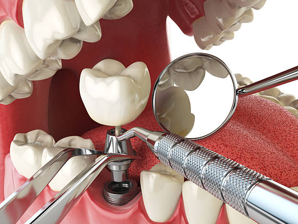 Professional Emergency Dental Service in WI